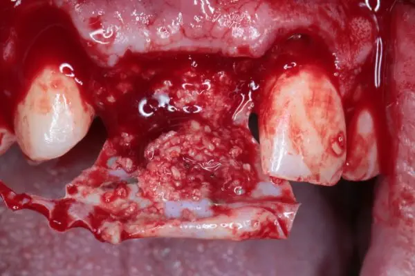 Specialize in Reconstructive Dental Surgery