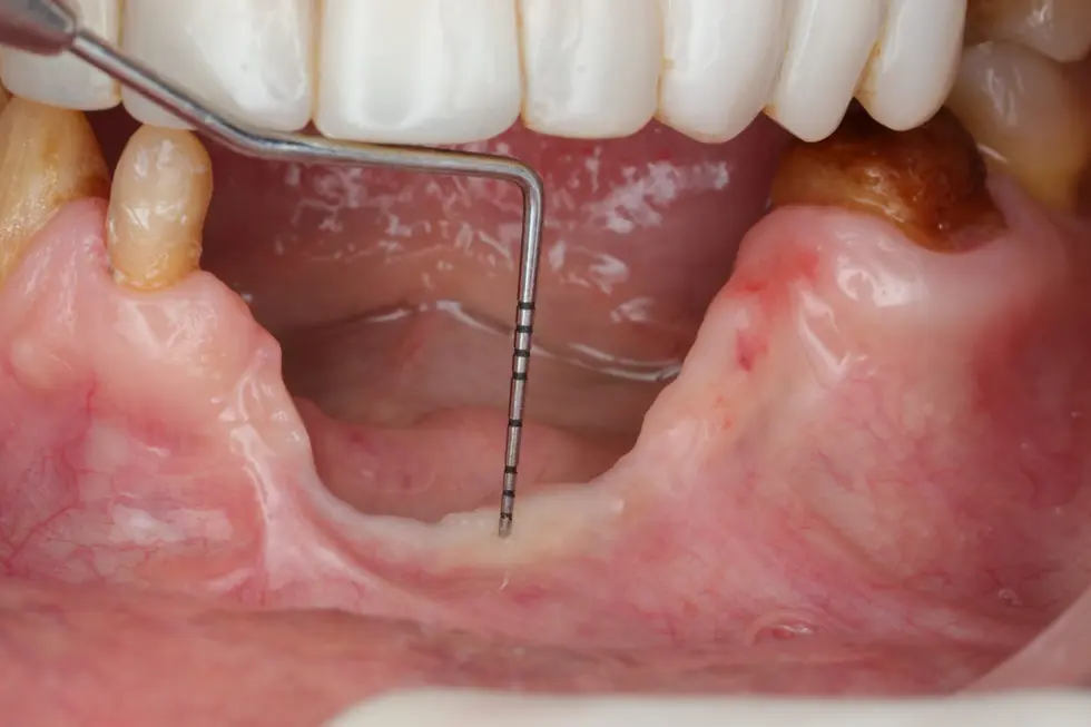 before-oral-reconstruction